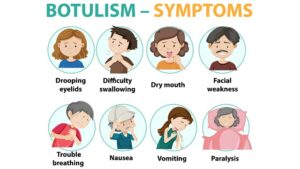 symptoms of botulism