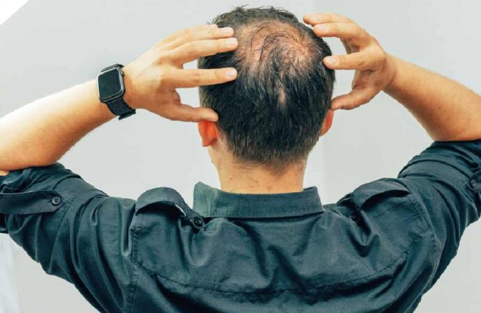 Buldhana District Faces Severe Hair Loss Outbreak Linked to Toxic Wheat