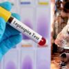 Kitchen Licence Suspended After Rat Fever Outbreak in Tirunelveli College