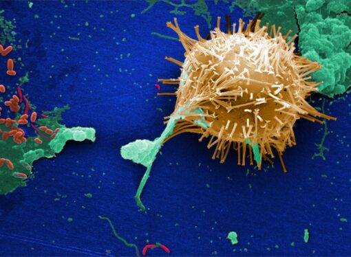 Seafood Tragedy in Vizhinjam: Marine Toxins Under Scanner