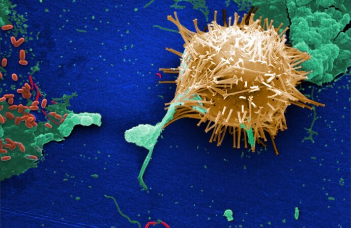 Seafood Tragedy in Vizhinjam: Marine Toxins Under Scanner