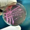 Kochi Mandi Outbreak: Three Shigella Cases Confirmed