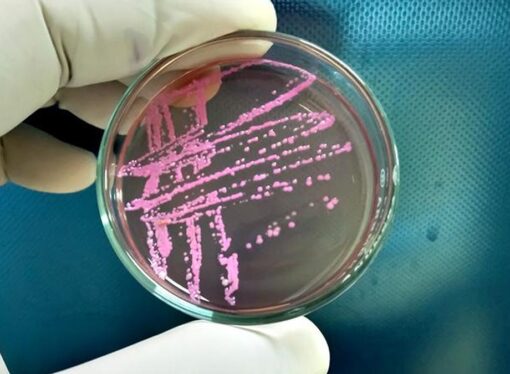 Kochi Mandi Outbreak: Shigella Cases Prompt Safe Food Advisory