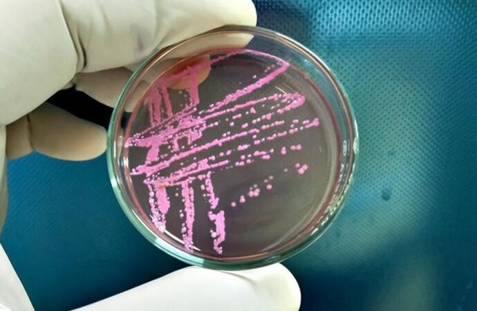 Kochi Mandi Outbreak: Shigella Cases Prompt Safe Food Advisory