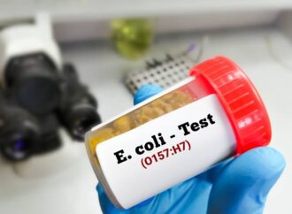 E. coli in Kochi Eatery Water: Bottling Units Set for Safety Checks