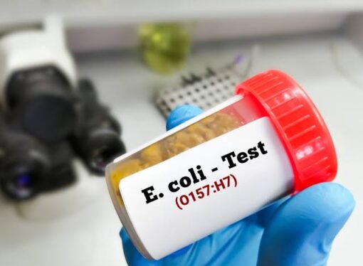E. coli in Kochi Eatery Water: Bottling Units Set for Safety Checks