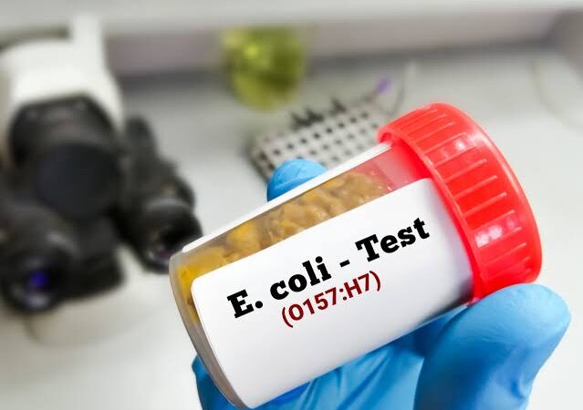 E. coli in Kochi Eatery Water: Bottling Units Set for Safety Checks
